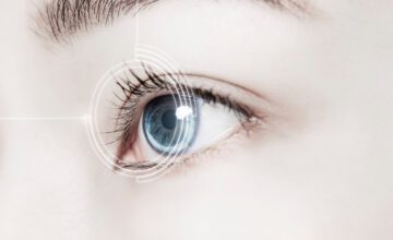 La chirurgie LASIK