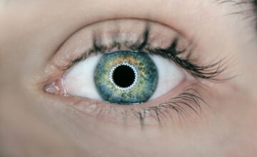 Les Implants de Lentilles Intraoculaires (ICL)
