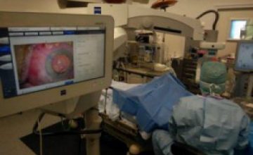 La chirurgie réfractive